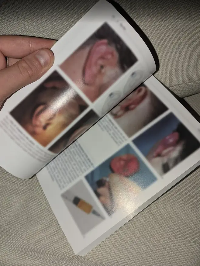 Color Atlas Of ENT Diagnosis — page 1